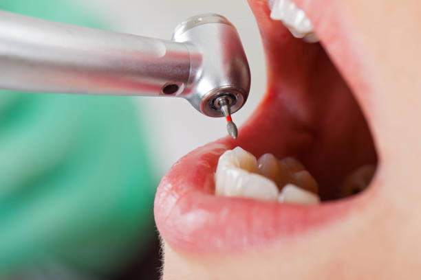 Best Emergency Root Canal Treatment in Vernon, WI